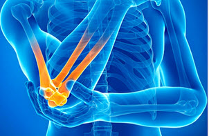 [Анна Воронина] Плечо. Запястье. Локоть (2020)_0.jpg